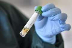 В Республике зарегистрировали 427 случаев инфекции COVID-19
