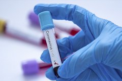 В ЛНР за сутки от коронавирусной инфекции скончался один человек