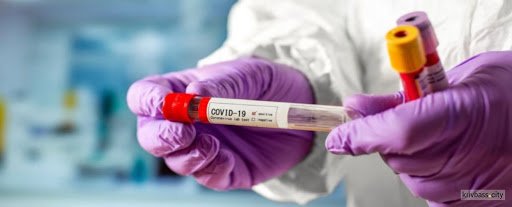 731 случай заражения COVID-19 зарегистровали в ЛНР