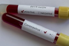 Медики за сутки зарегистрировали в ЛНР семь летальных случаев от COVID-19