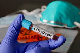 Медики за сутки зарегистрировали в ЛНР три летальных случая от COVID-19