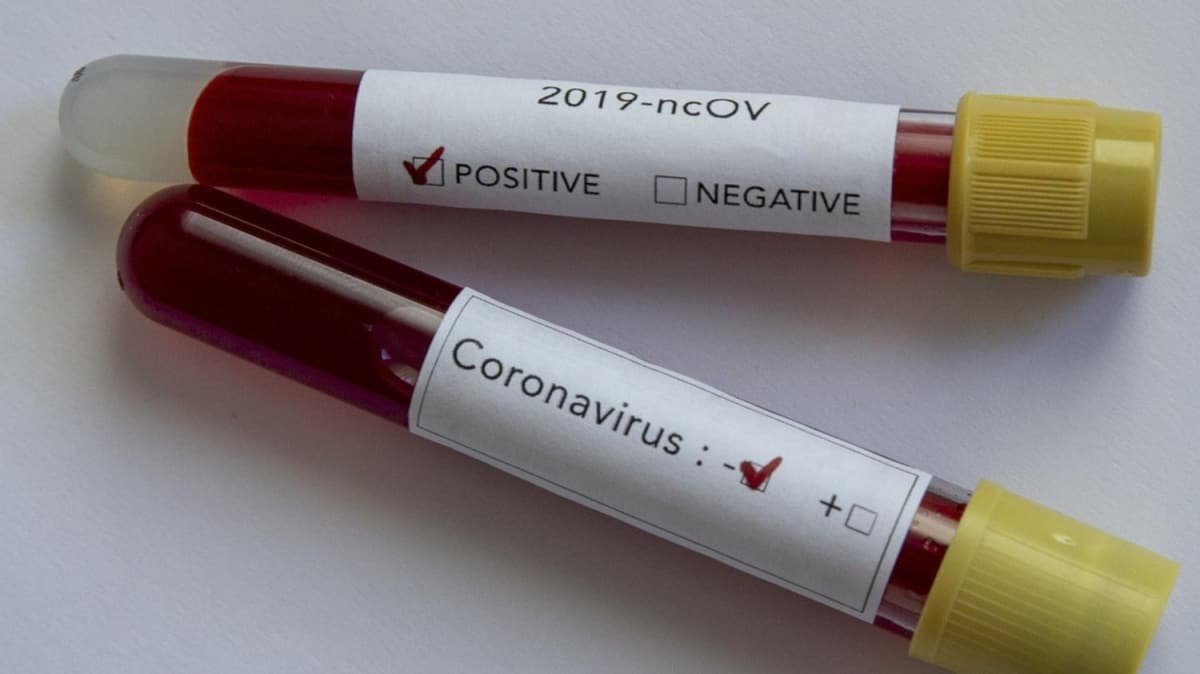 Медики за сутки зарегистрировали в ЛНР два летальных случая от COVID-19