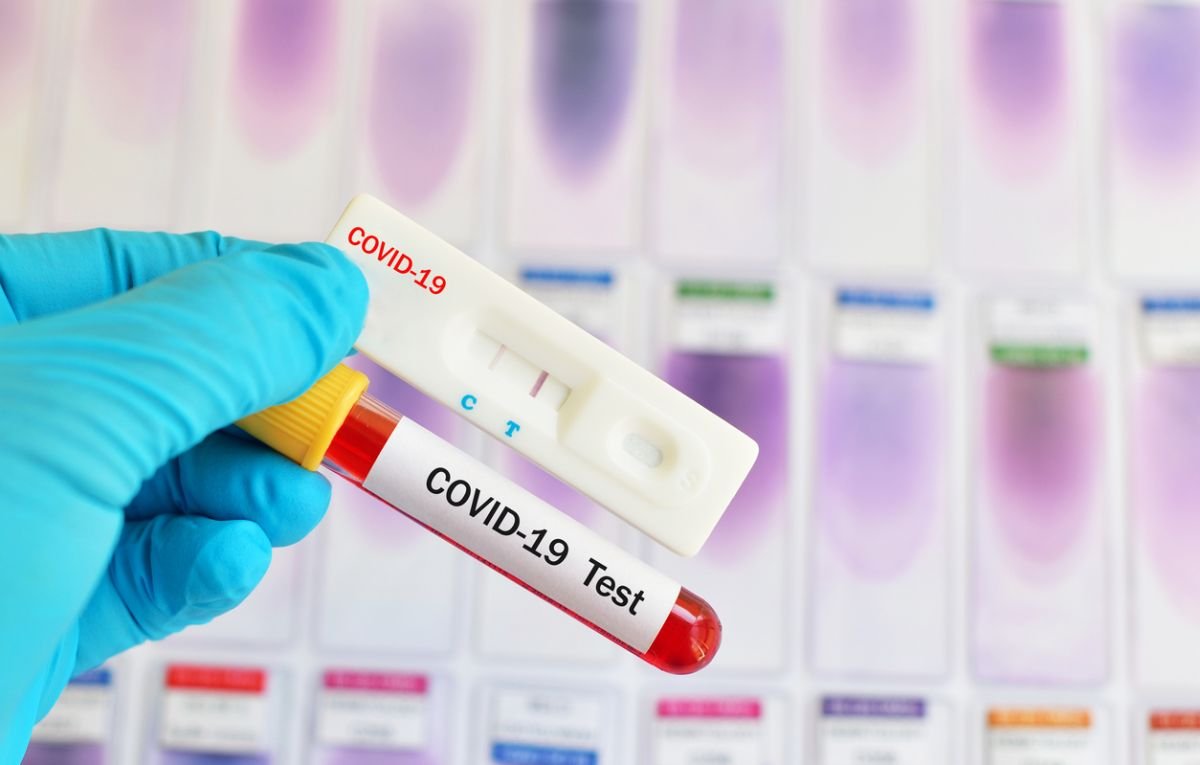 В ЛНР зарегистрировали 2082 случая заражения COVID-19
