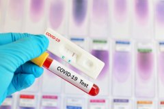 В ЛНР зарегистрировали 2082 случая заражения COVID-19